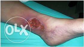 Enfermagem ao Domicilio