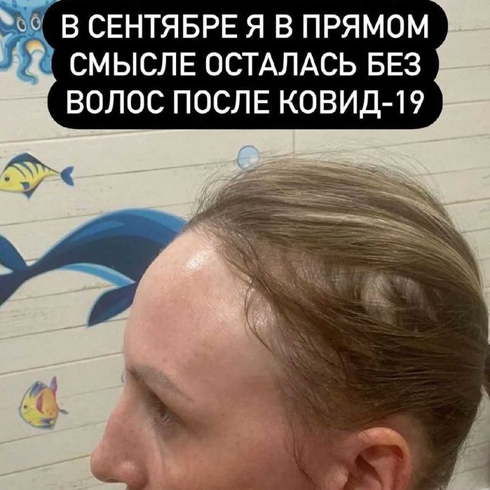 Occuba Сыворотка против выпадения волос