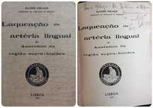 Laqueação da Artéria Lingual e Anatomia da Região Supra-hioidea