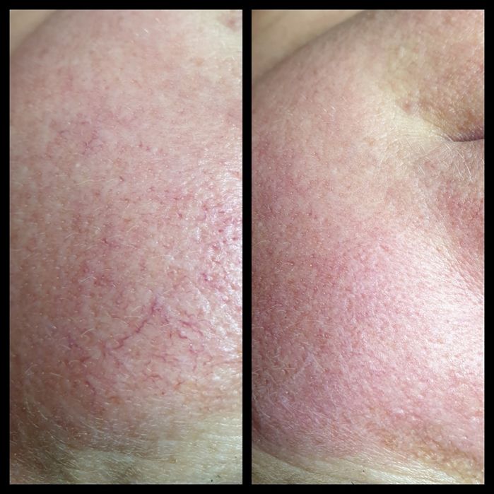 Косметолог- эстетист ,Теремки ,Голосеевский р-н. Выезд на дом .