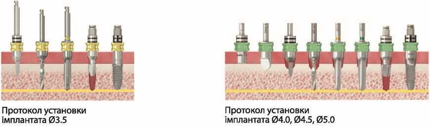 Набір навігаційний Neo Navi Guide Kit
