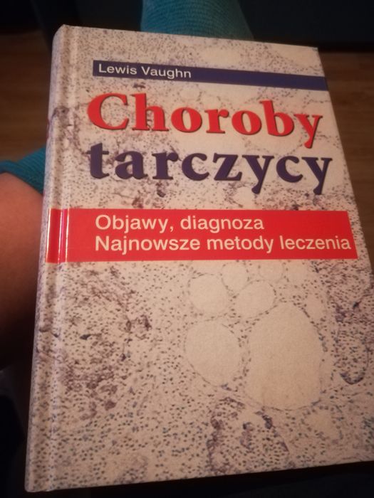 Choroby tarczycy