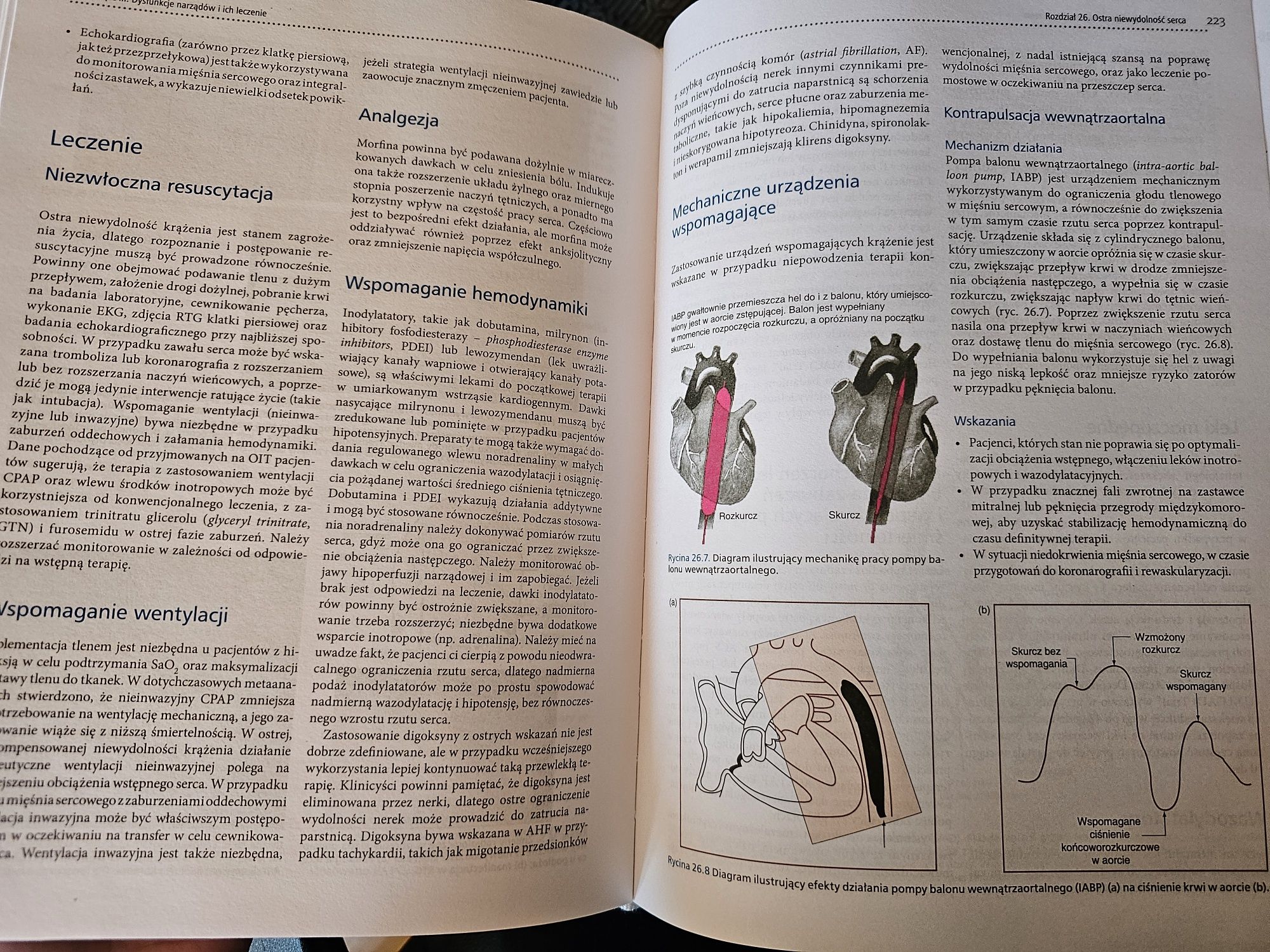 Intensywna terapia najwazniejsze zagadnienia Joyce Yeung, Fang Gao Smi