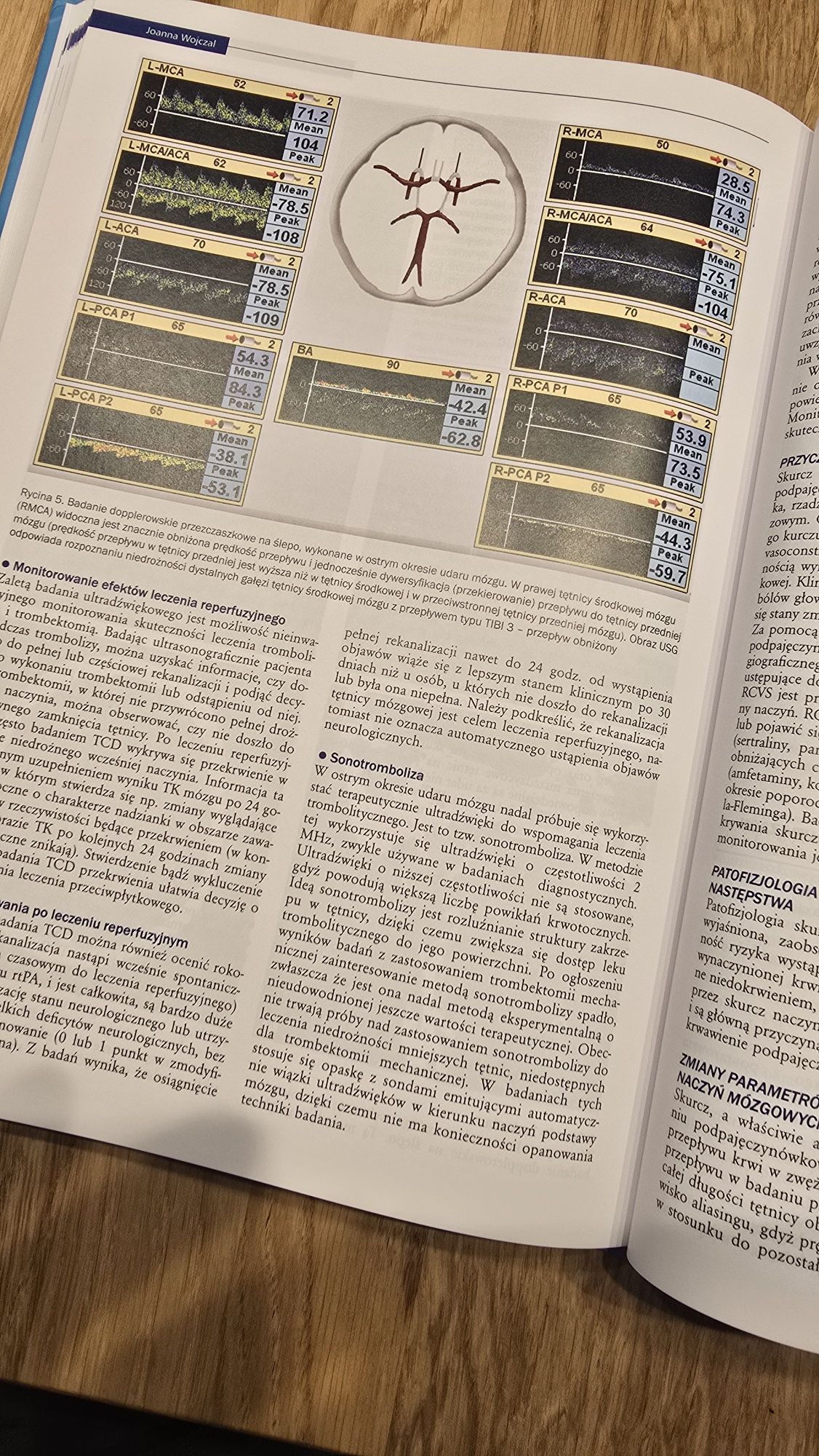 Neurologia A.Stępień tom I,II i III