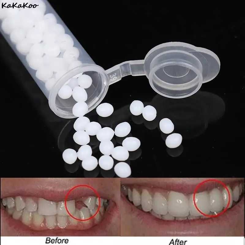 Клей для ремонту зубів
