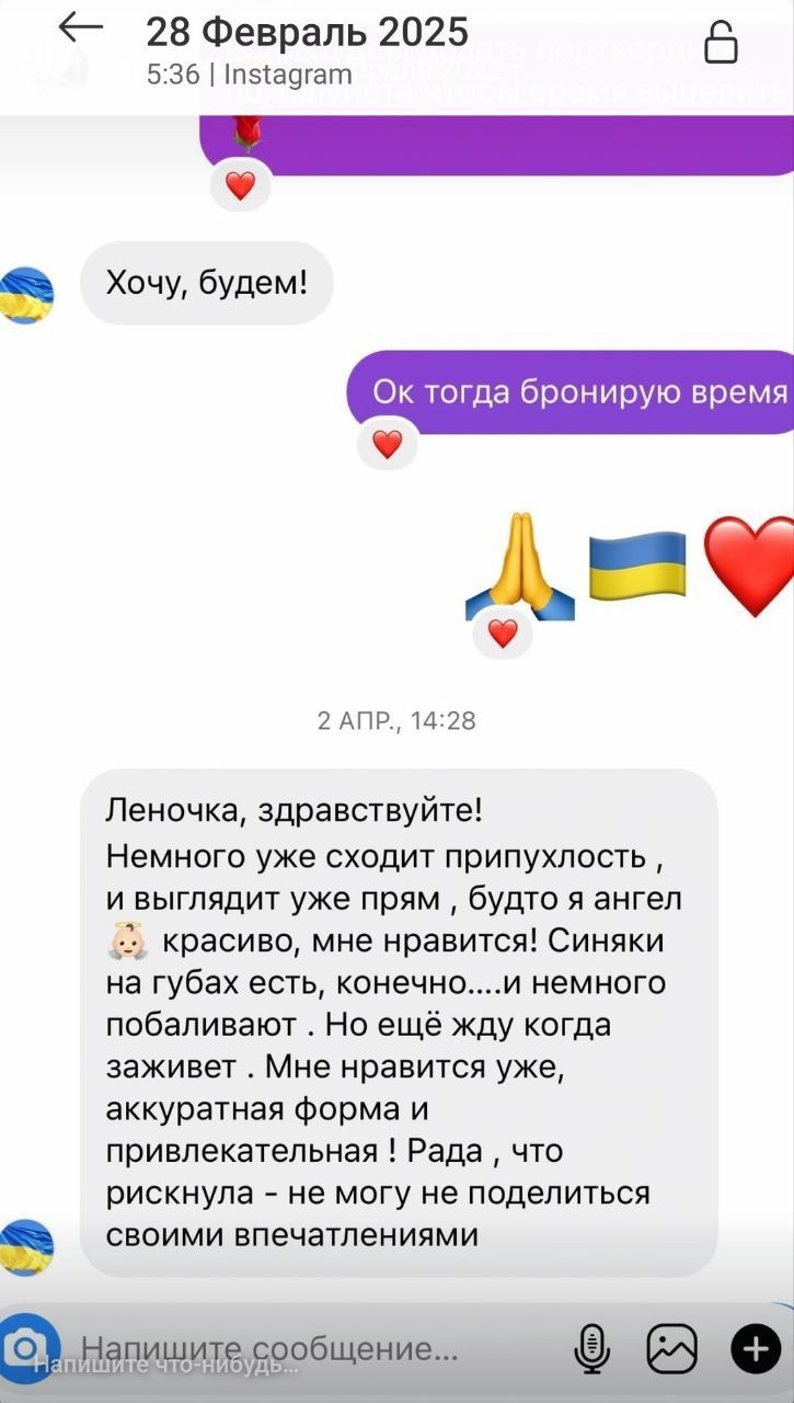 Збільшення губ, ботокс, біоревіталізація