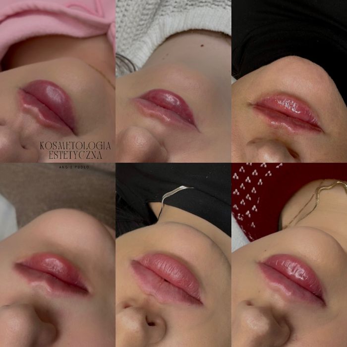 Kosmetologia estetyczna Angie Pudło