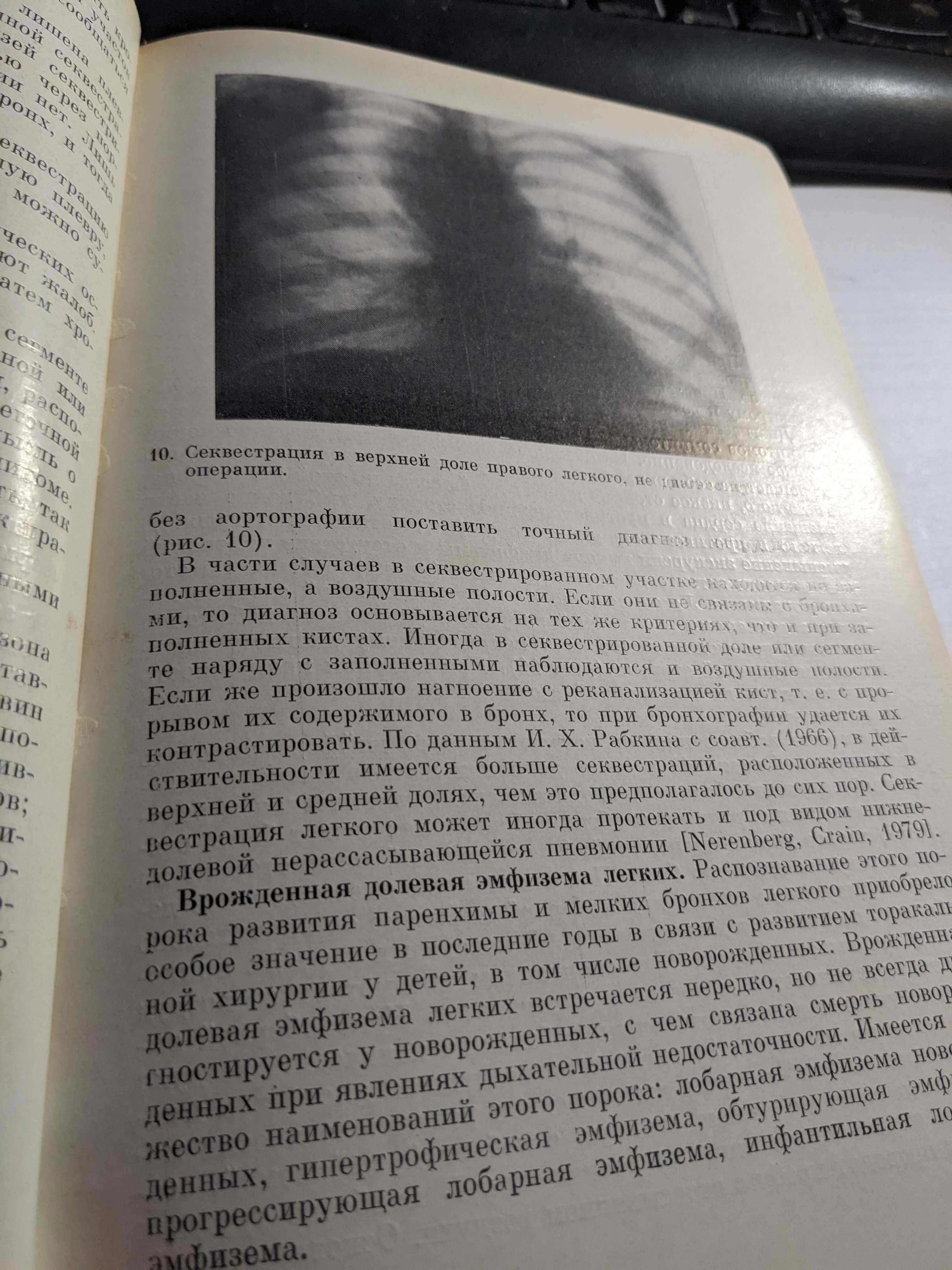 Книга клінічна Рентген -Радіологія