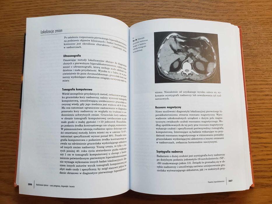 Nadciśnienie tętnicze - Andrzej Januszewicz. Wyd. IV - Kraków 2007