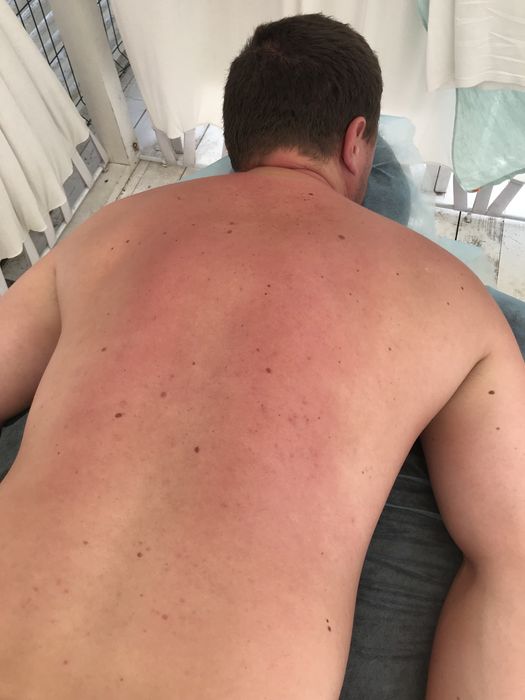 Лікувальний масаж