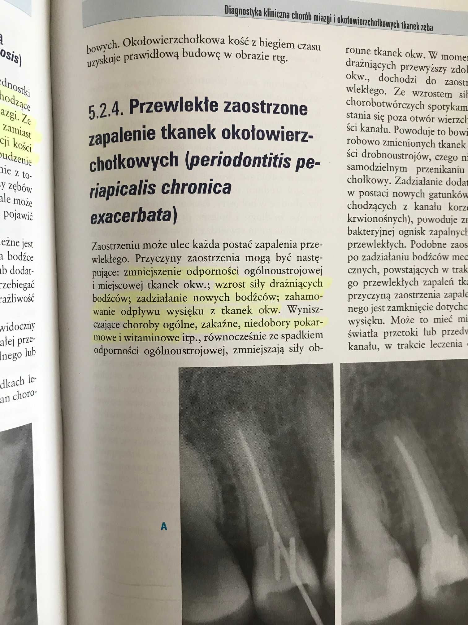 Endodoncja wieku rozwojowego i dojrzałego Barańska-Gachowska