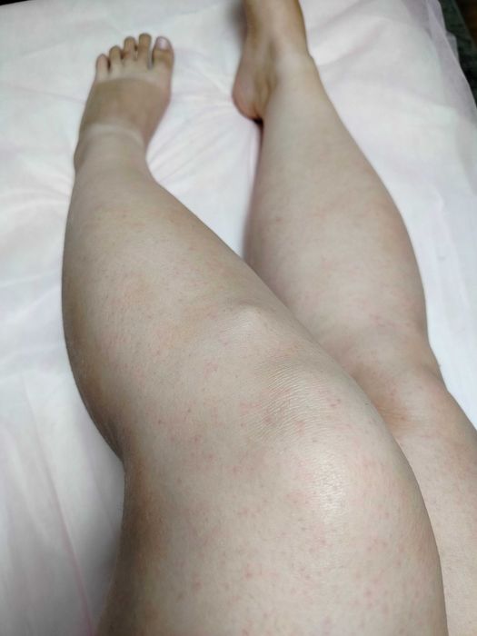 Депіляція, метро Дарниця,Воскресінка,Троєщина,Лівий берег