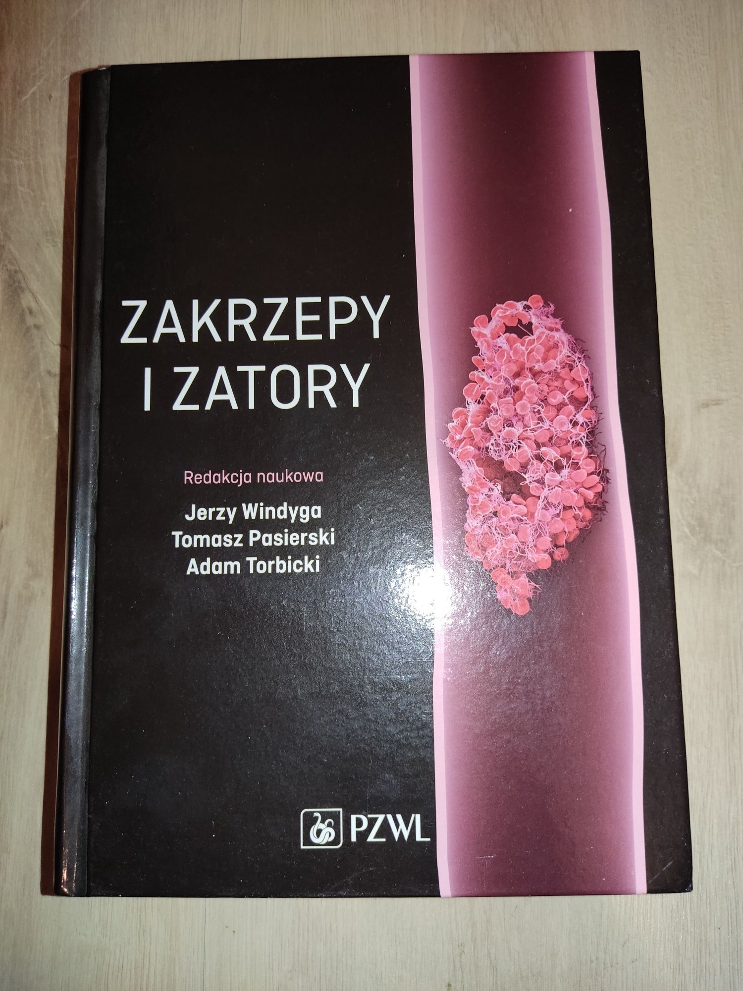 Zakrzepy i zatory