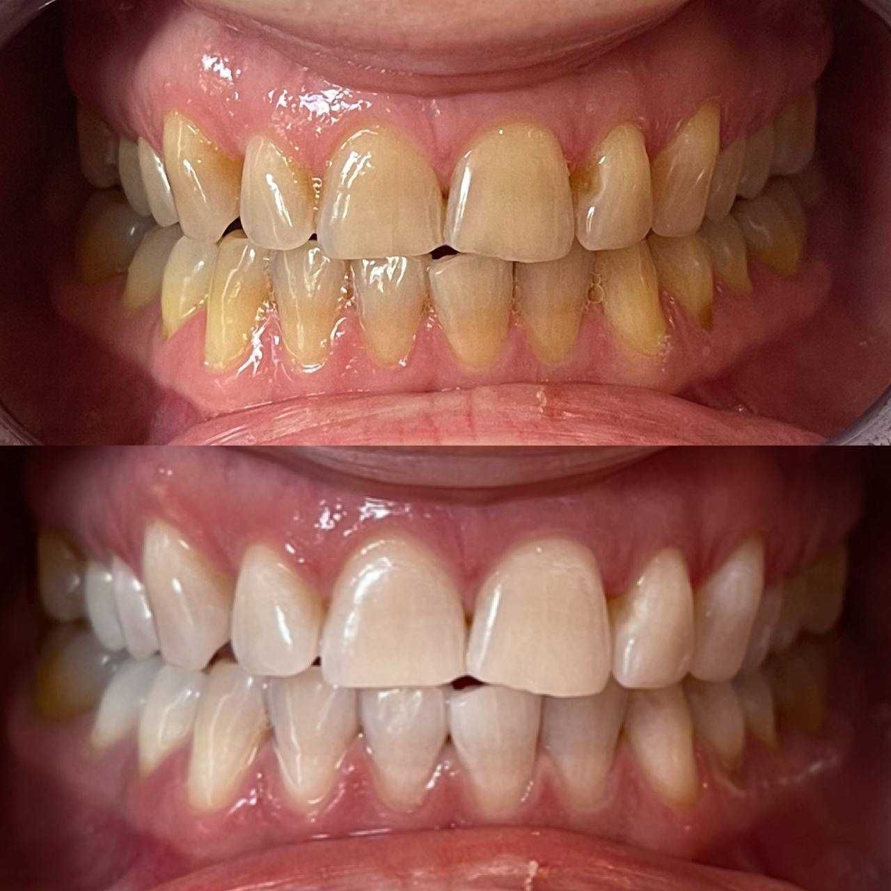 Косметичний бізнес / Франшиза відбілювання зубів Smile LAB
