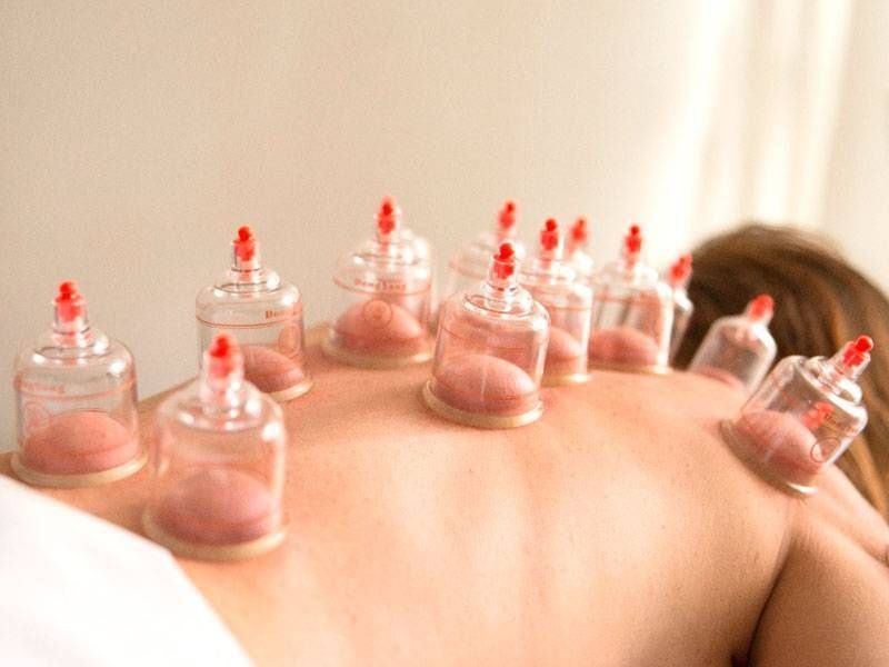 Tratamento de ventosa terapia