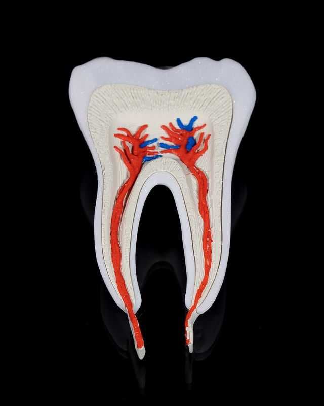 Modele stomatologiczne Budowa zęba implant kanały korzeniowe 3D Druk