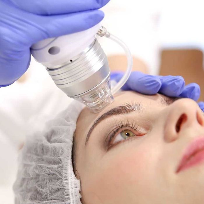 Rf лифтинг, Игольчатый Rf, коррекция рубцов пост акне