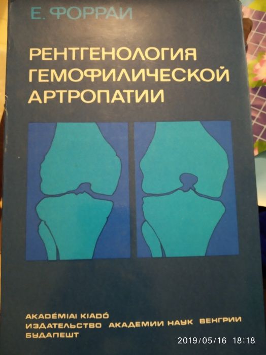 Рентген книжка гемофилия гемофілія артропатия артропатия 1981
