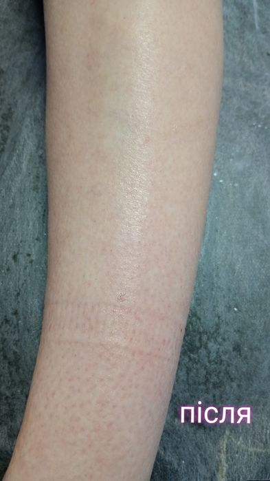 Воскова депіляція