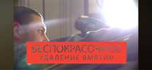 Удаление вмятин без покраски (PDR)