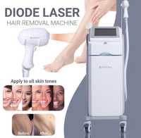 Диодный лазер для удаления волос Photon R ,цена актуальна до15.03.2024