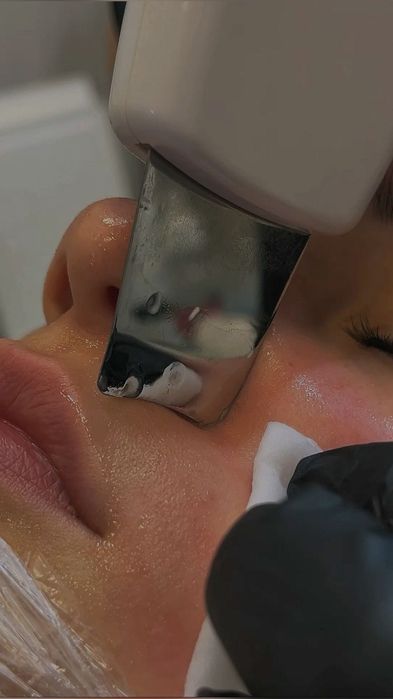 Чистка обличчя шиі та зони декольте