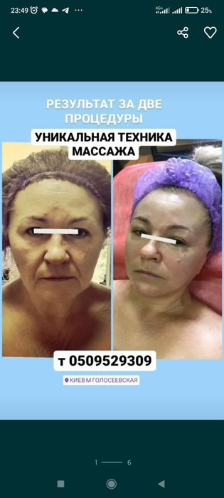 Масаж обличчя  моделюючий,лімфодренажний,міофасціальний м Голосеевская