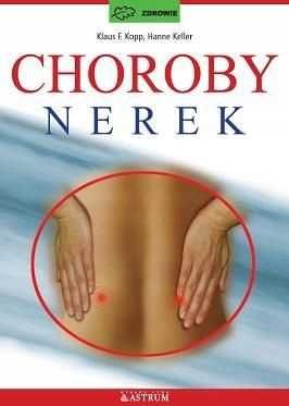 Choroby nerek Keller Kopp NOWA