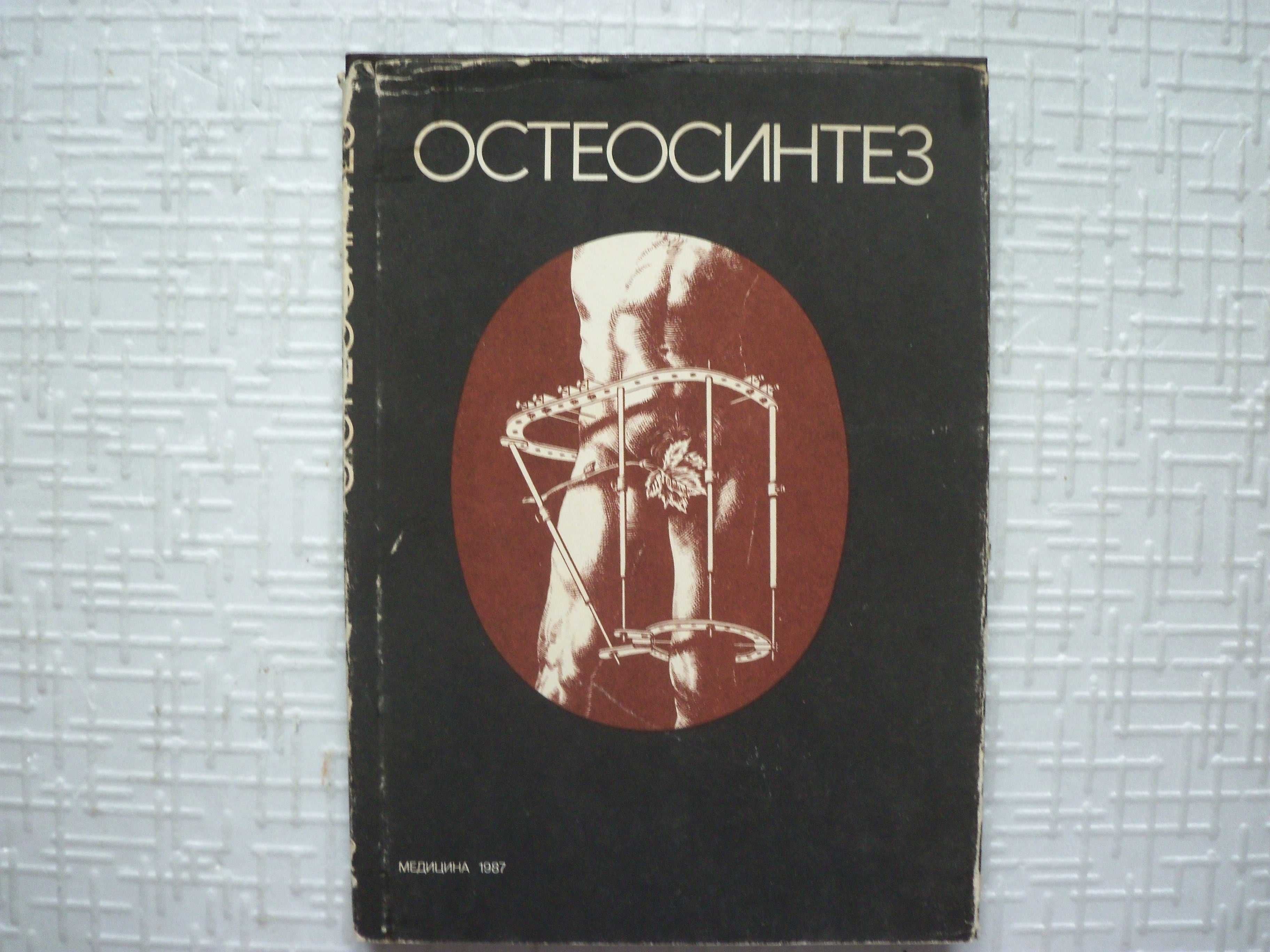 .Остеосинтез. Руководство для врачей. Под ред. Ткаченко С.С.