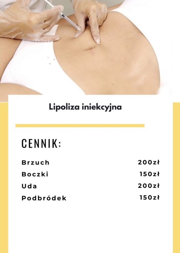 Powiększanie ust,stymulatory tkankowe,botox,Rzesy,lipoliza,dermapen,op