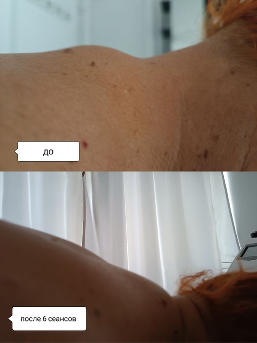 Масаж спини класичний,массаж загальний, масаж ШКЗ, масаж стоп