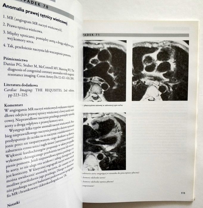 Diagnostyka obrazowa SERCE. Przypadki kliniczne, Reddy, Steiner, NOWA!