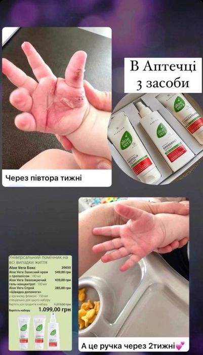 LR Aloe Vera Skin Gel – 90% соку алое для шкіри зволоження загоєння