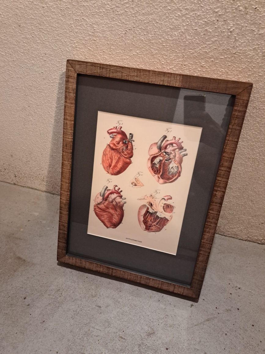 Serigrafia coração com moldura da mool