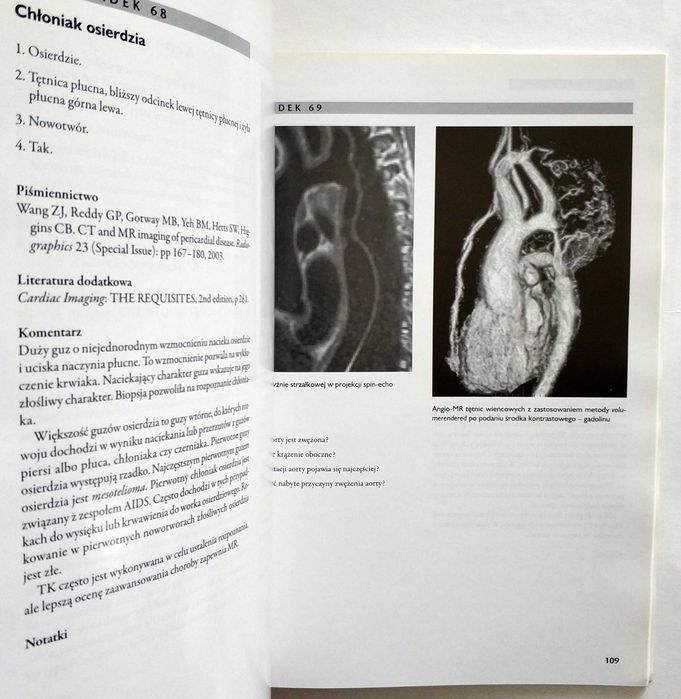 Diagnostyka obrazowa SERCE. Przypadki kliniczne, Reddy, Steiner, NOWA!