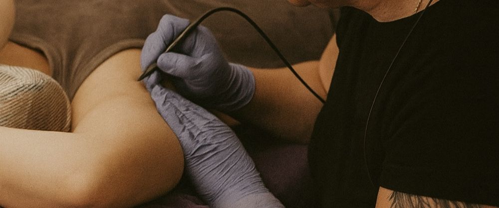 Електроепіляція Чигирин