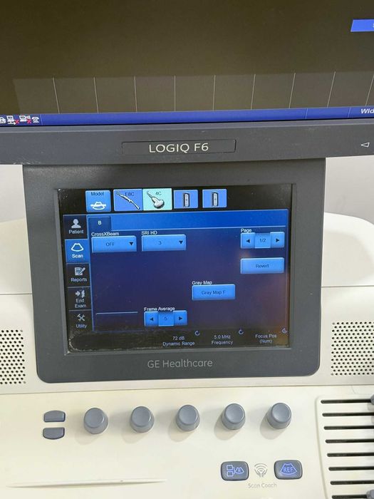 Usg GE Logiq F6 ultrasonograf