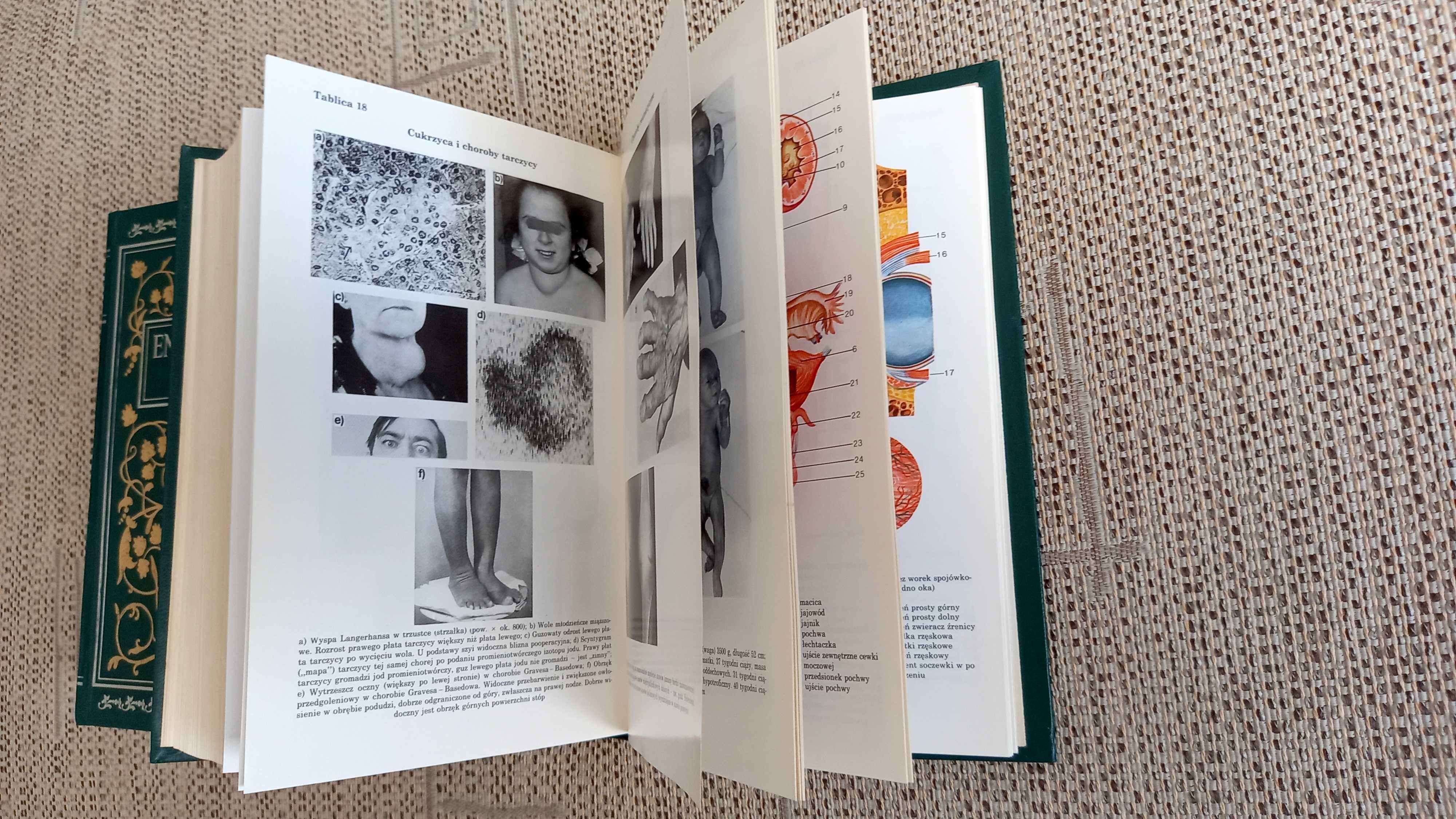 Encyklopedia Zdrowia PWN, tom 1 i 2