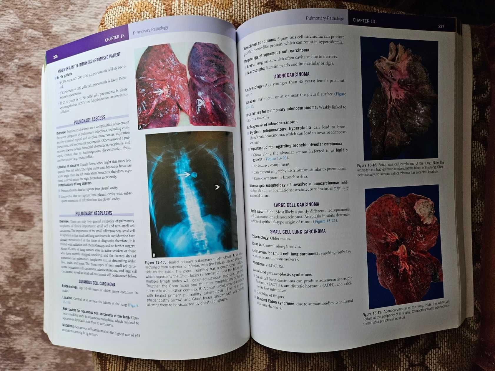 Pathology - Mange j.angielski