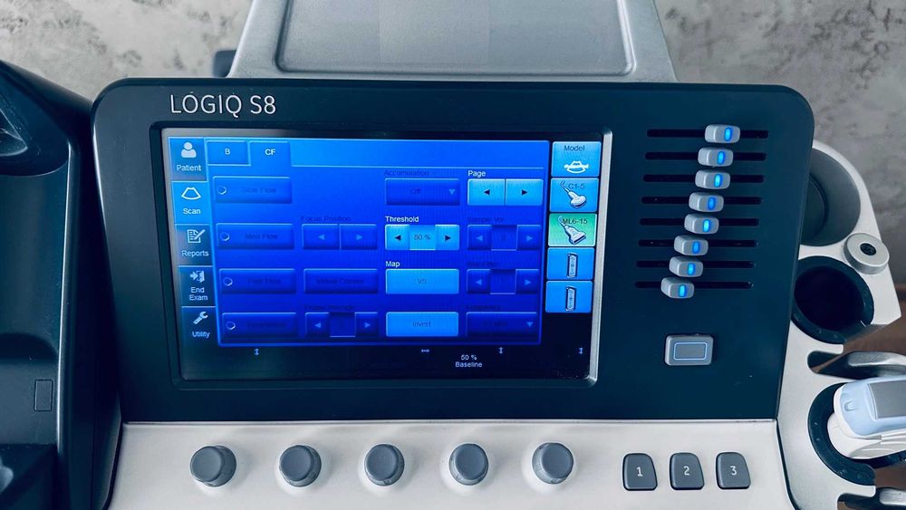 УЗД GE LOGIQ S8 XDclear 2.0 + 3 датчика  (2016 р.в.)