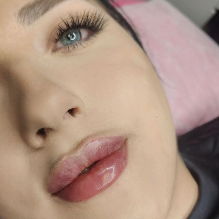 Powiększanie i modelowanie ust 350 zł