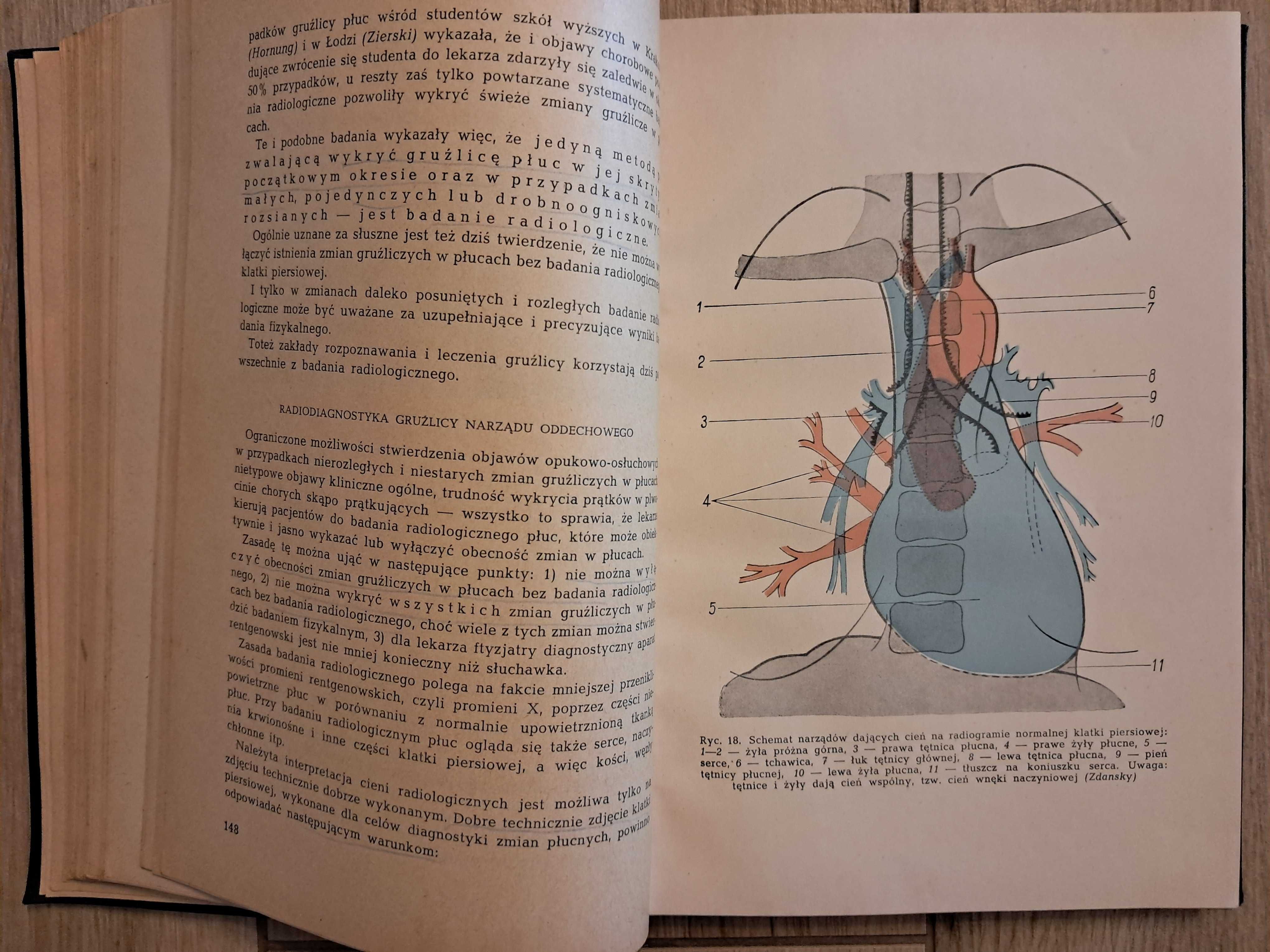 Ftyzjatria - J. Misiewicz - 1954r - podręcznik dla studentów medycyny