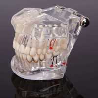 Model uzębienia dla dentystów/pacjentów