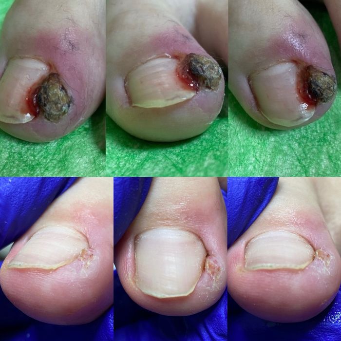 Подолог. Медичний педикюр