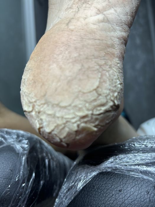 Дмитровка,Горишние плавни ,педекюр