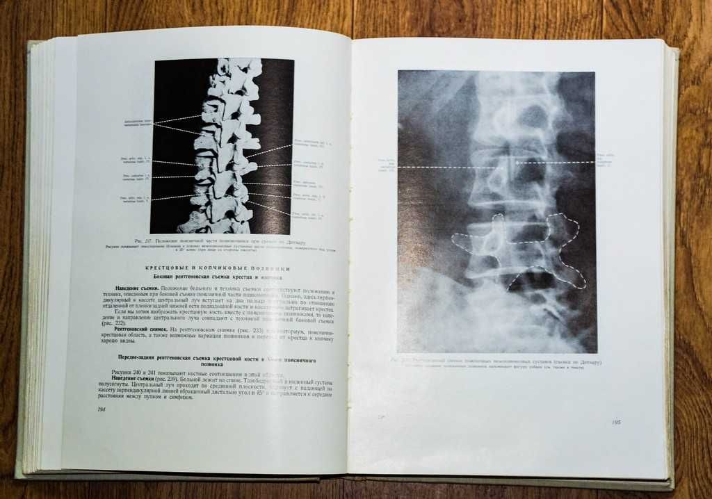 Рентгеновская анатомия 1961г.