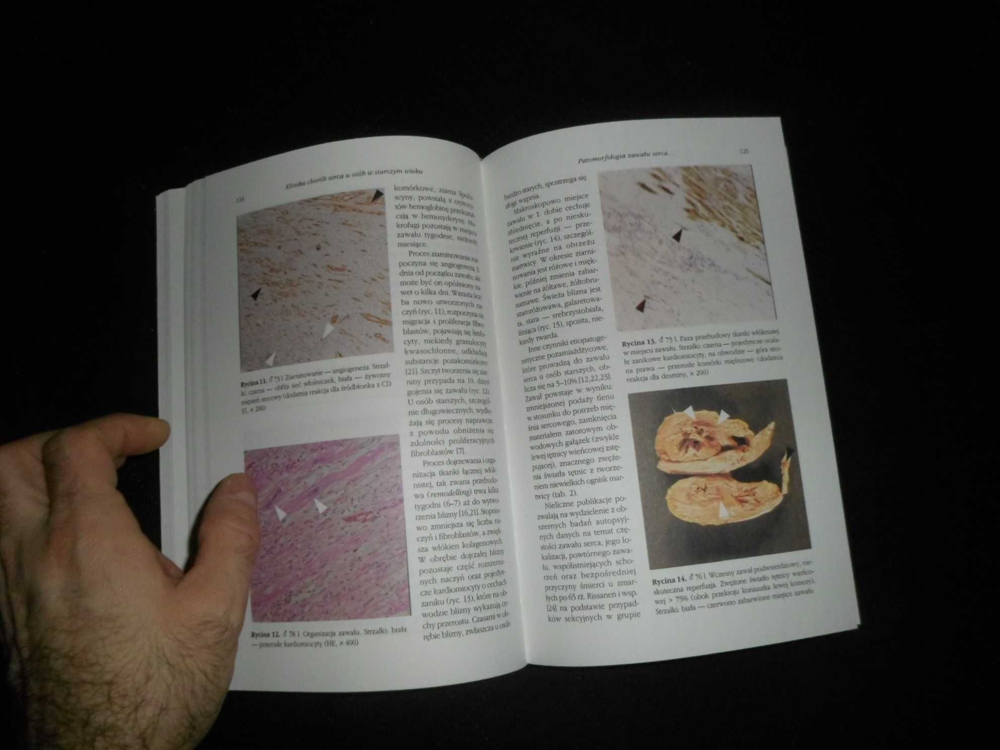 Kardiologia starszego wieku pod red. Grażyny Świąteckiej