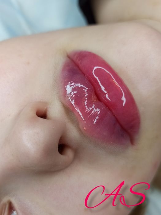 Косметолог/Ботокс/Збільшення губ/МОДЕЛІ