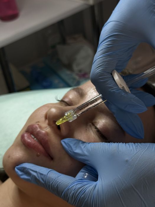 Косметолог кривий ріг чистка обличчя ботокс збільшення губ