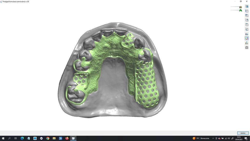 Зубний технік CAD/CAM Проектування конструкцій в 3shape Dental System